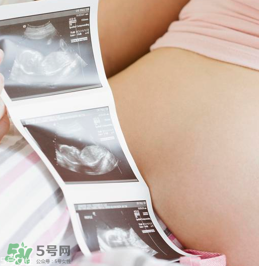 頭胎雙胞胎還能生二胎嗎？雙胞胎家庭能要二胎嗎？