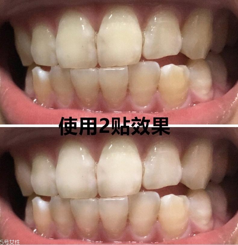 佳潔士美白牙貼貼多久有效？佳潔士美白牙貼使用感受