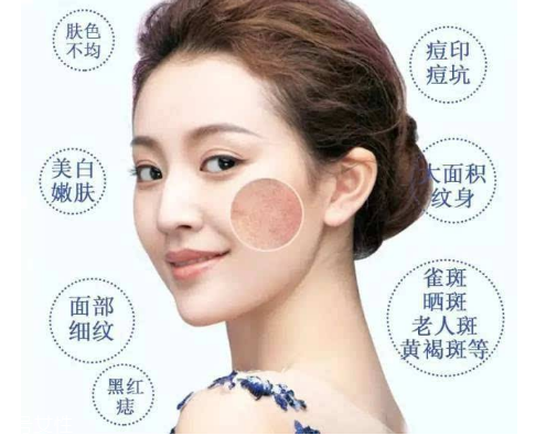 皮秒會反黑嗎 這是正?，F(xiàn)象