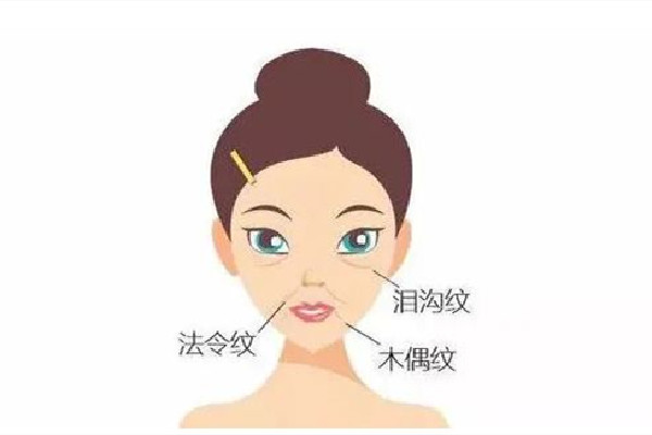 武漢玻尿酸填充淚溝多少錢(qián) 武漢玻尿酸填充淚溝去哪里做
