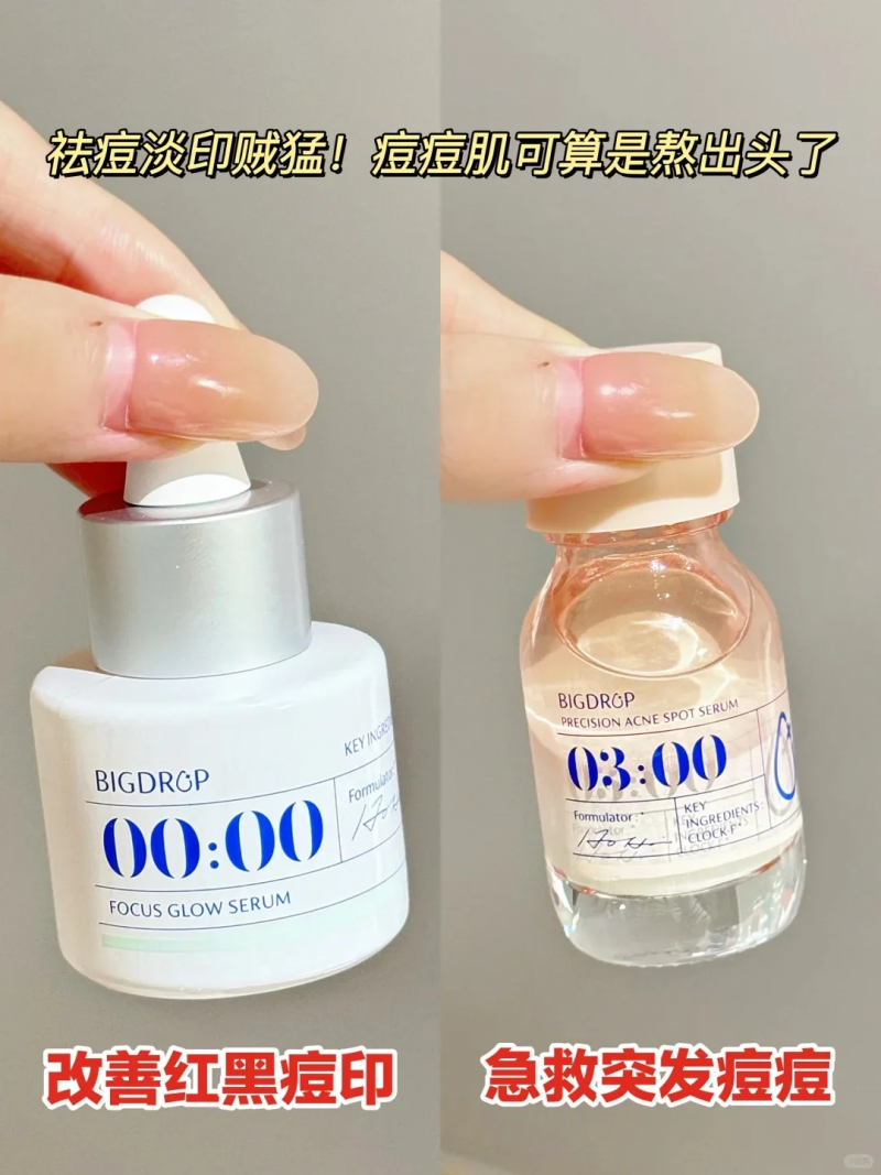 祛痘產(chǎn)品橫測：谷雨白千祛痘凝膠、大水滴與達(dá)爾膚杏仁酸，誰是祛痘王者？